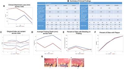 Non-human Primate Macaca mulatta as an Animal Model for Testing Efficacy of Amixicile as a Targeted Anti-periodontitis Therapy